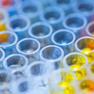 State Crime Lab DNA ‘Hits’ Rise